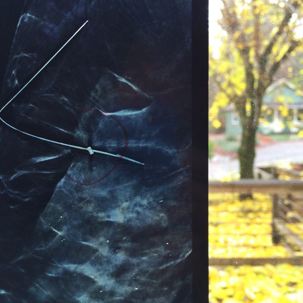 Moira-McLaughlin-Breast-Scan